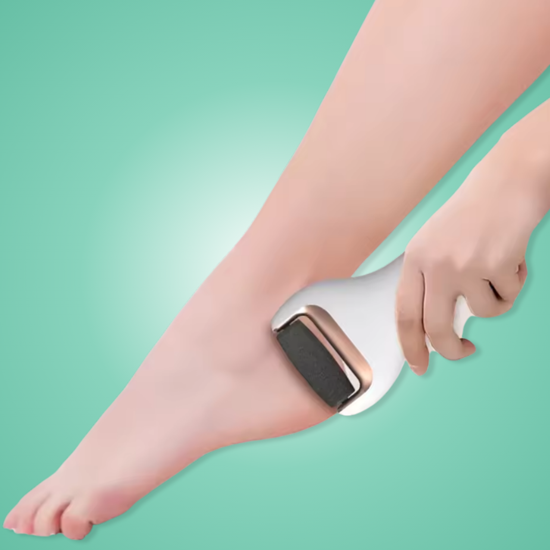 Evorola™ Electric Callus Remover